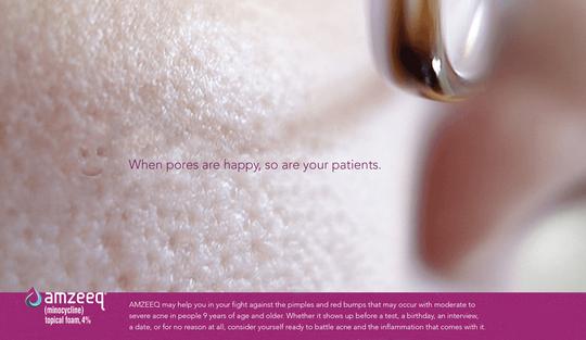 Amzeeq topical acne foam